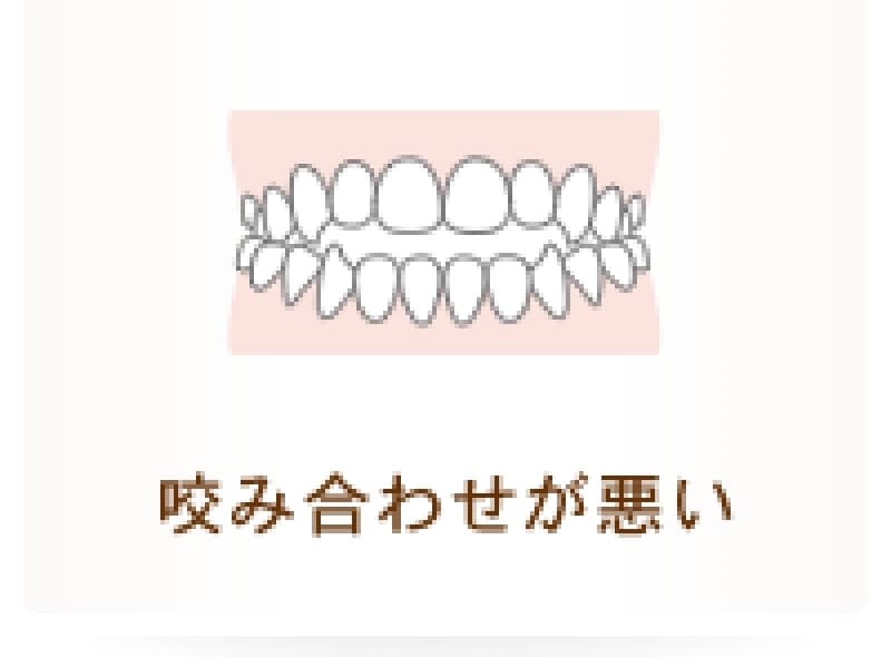 咬み合わせが悪い