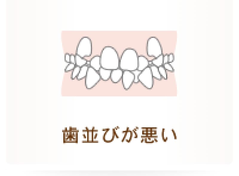 歯並びが悪い